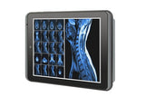 Arbor M0830 - 8" Intel® Atom™ Z8350 Mobile Clinical Assistant